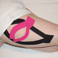 iliotibial